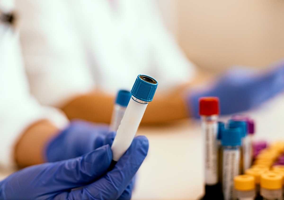 Moleküler Alerji Testi Neden Daha Doğru Sonuç Veriyor