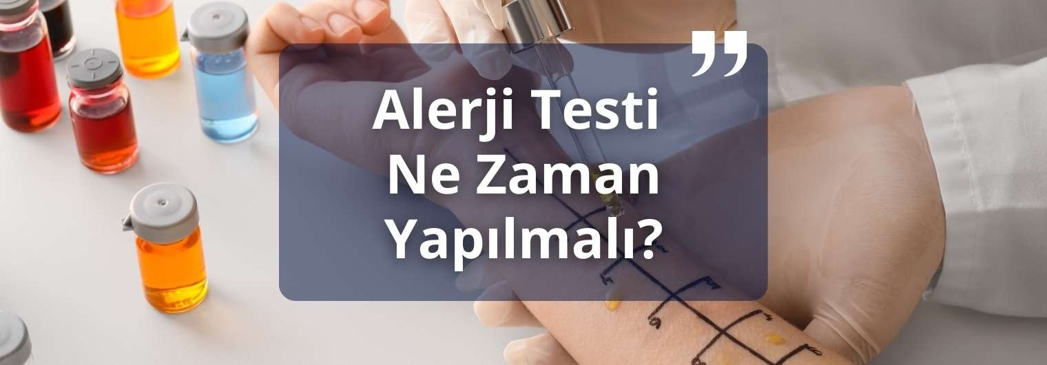 Alerji testi ne zaman yapılmalı