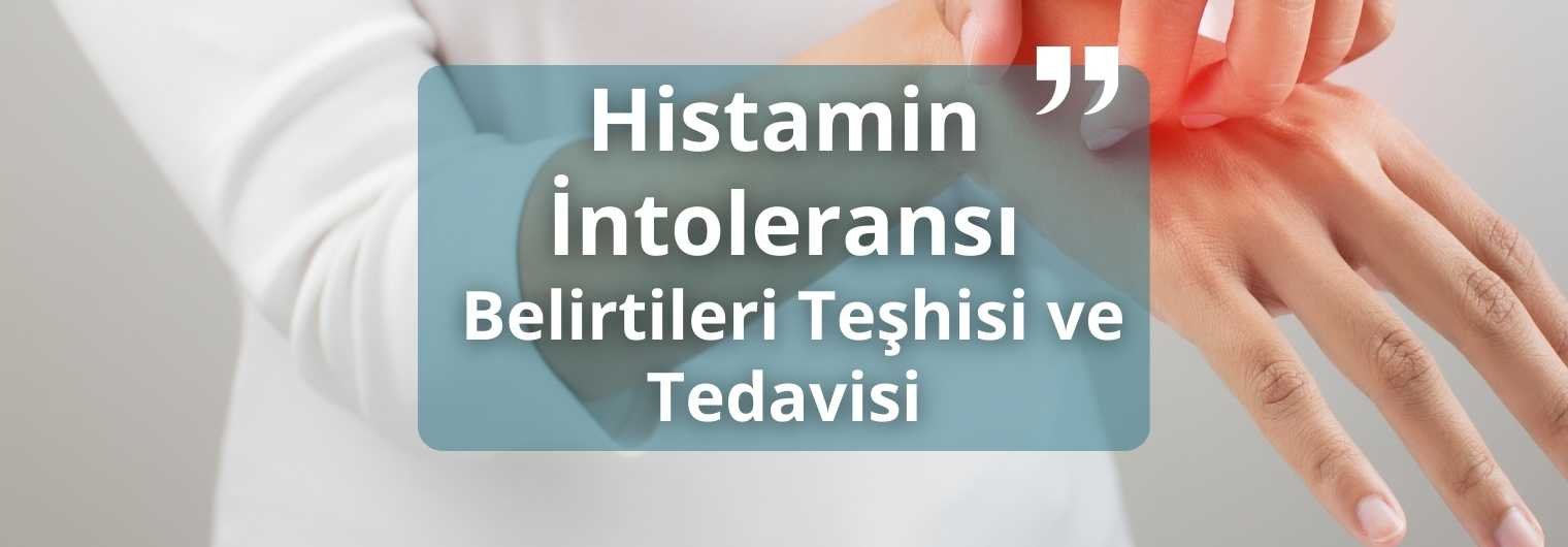 Histamin İntoleransı Belirtileri Teşhisi ve Tedavisi