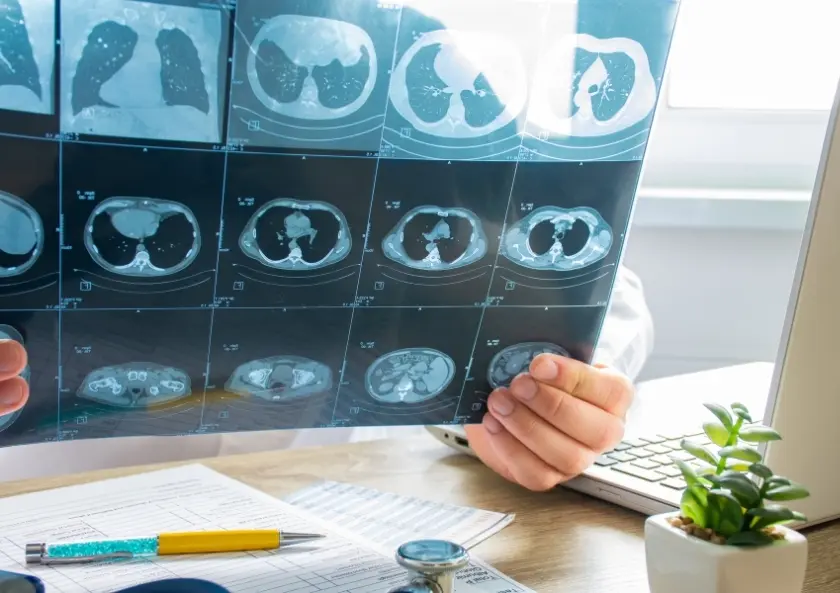 Göğüs Hastalıkları