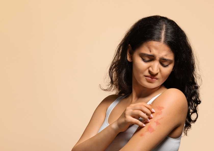 Stres ve Atopik Dermatit Arasındaki Bağlantı Psikolojik Etkiler