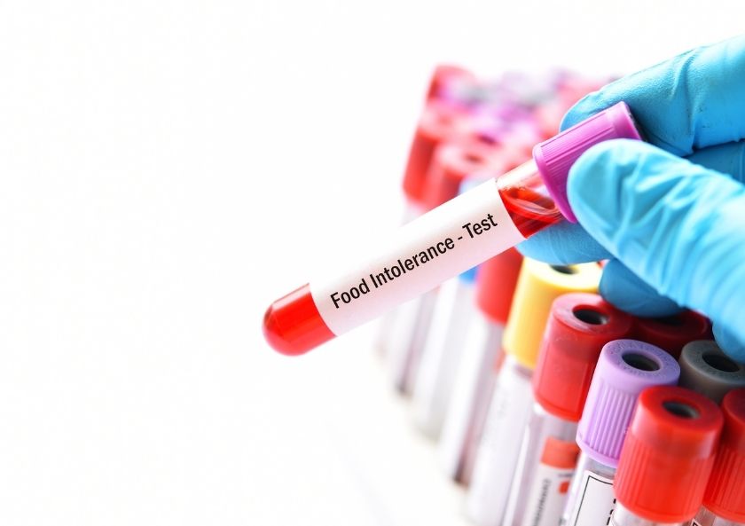 DR. FOOKE IgG4 Besin İntolerans Testi