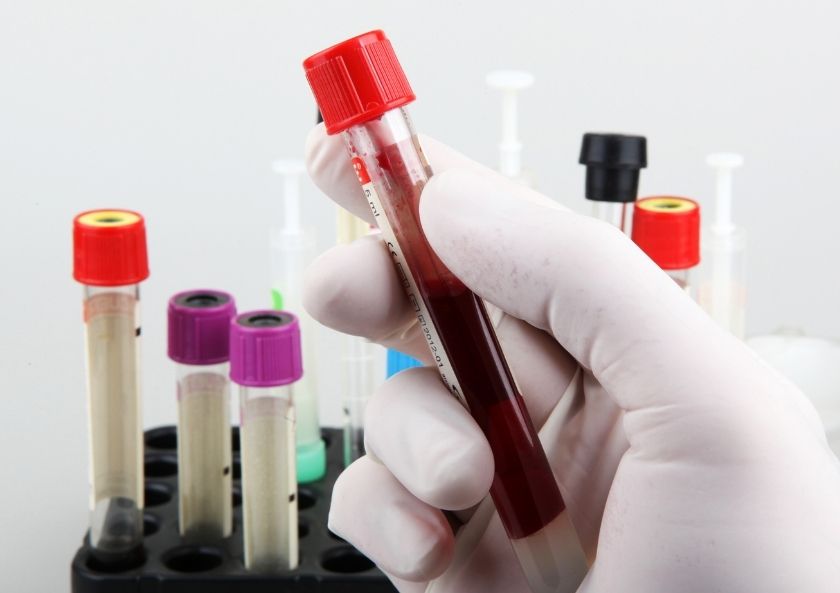 Neden ALFA Metodu ile Moleküler Alerji Testi Yapmalısınız