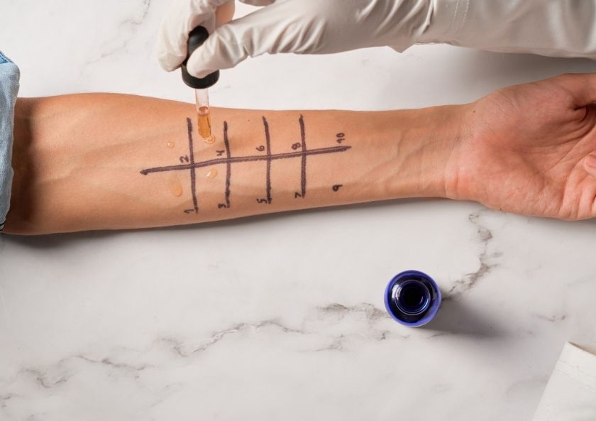 Alerji Testleri Neden Yanlış Sonuç Verebilir