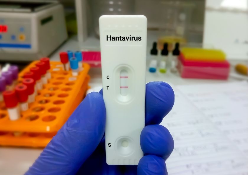 Hanta Virüsü Belirtileri