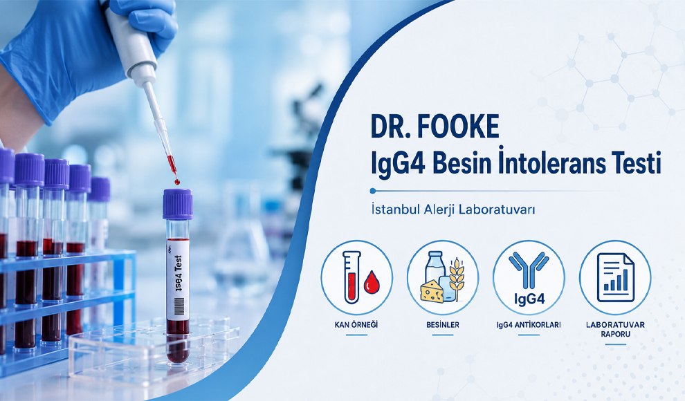 DR. FOOKE IgG4 Besin İntolerans Testi