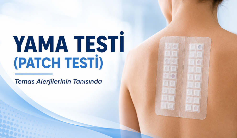 Yama Testi (Patch Testi)