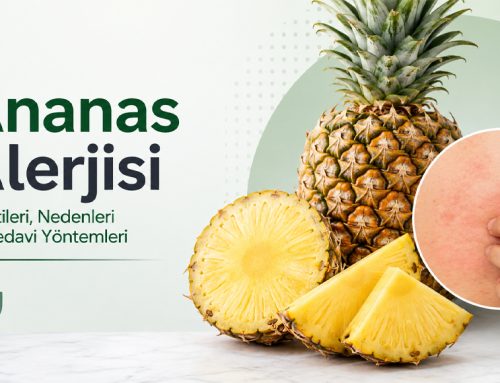Ananas Alerjisi