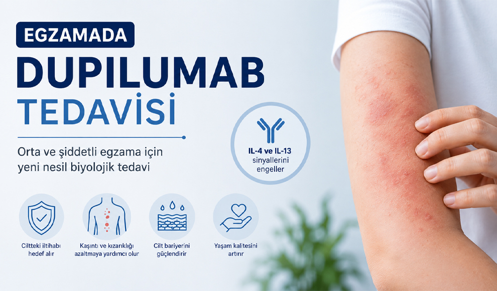 Egzamada Dupilumab Tedavisi