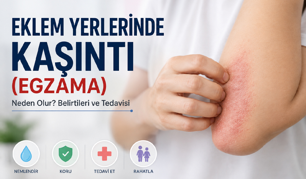 Eklem Yerlerinde Kaşıntı (Egzama)