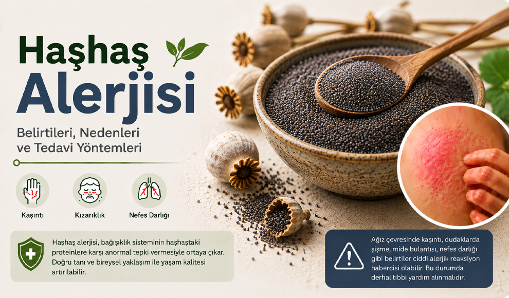 Haşhaş Alerjisi