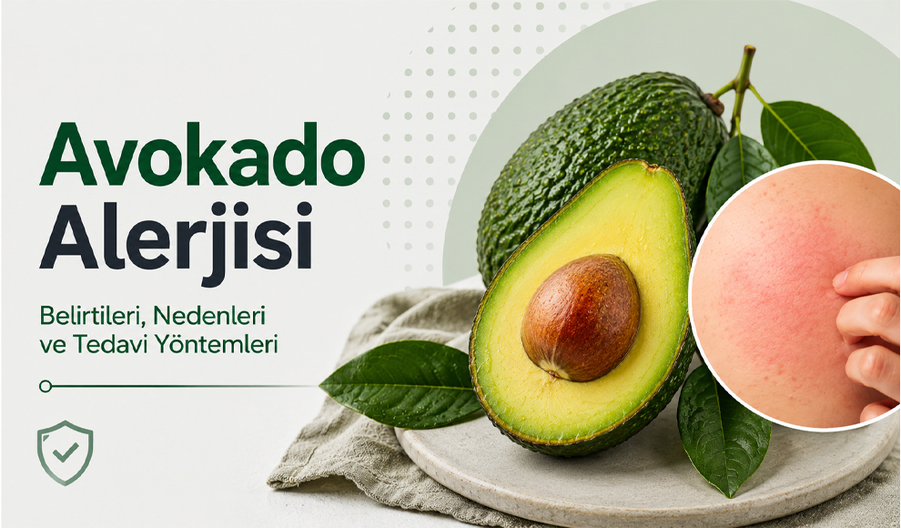 avokado alerjisi avokado alerjisi