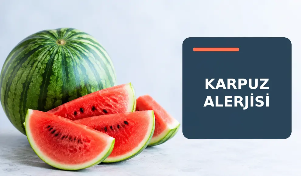 Karpuz Alerjisi