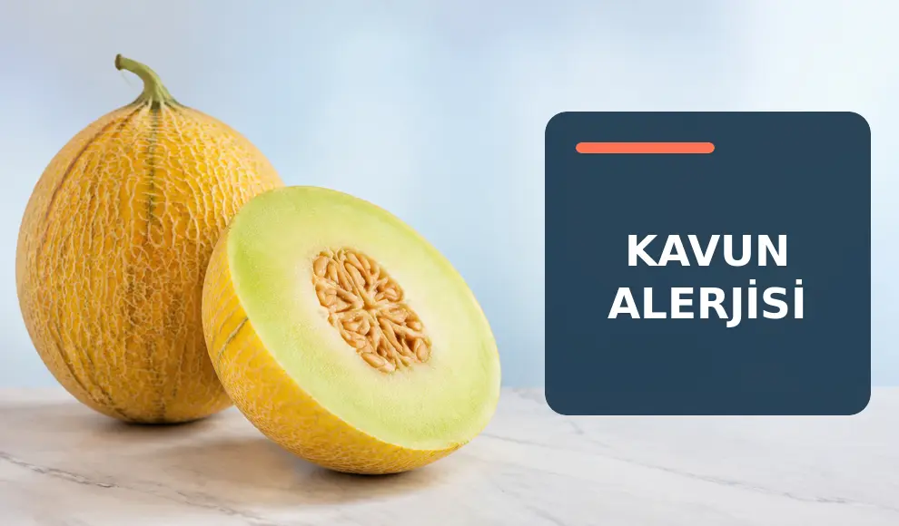Kavun Alerjisi