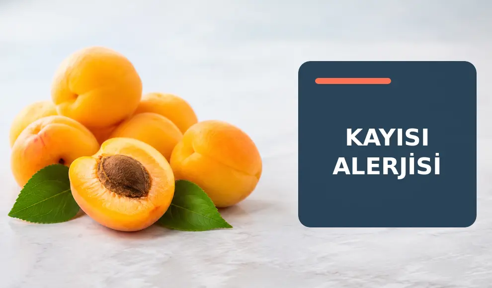 Kayısı Alerjisi