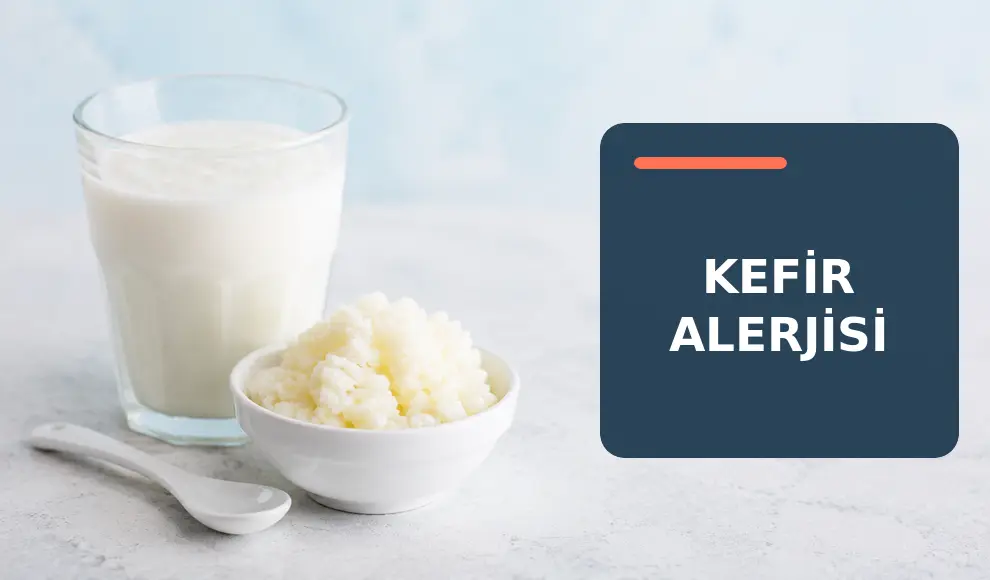 Kefir Alerjisi