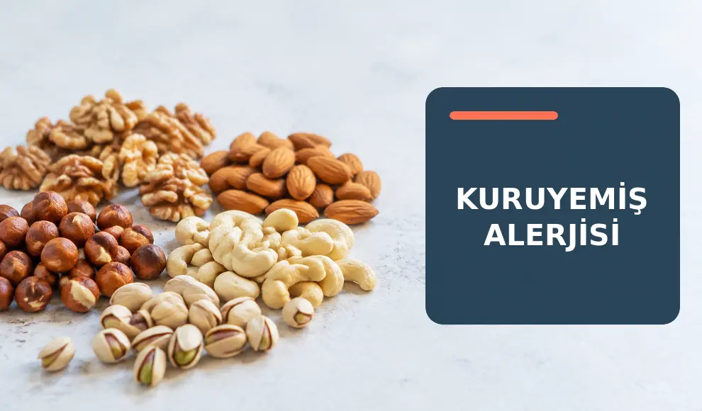 Kuruyemiş Alerjisi Kuruyemiş Alerjisi