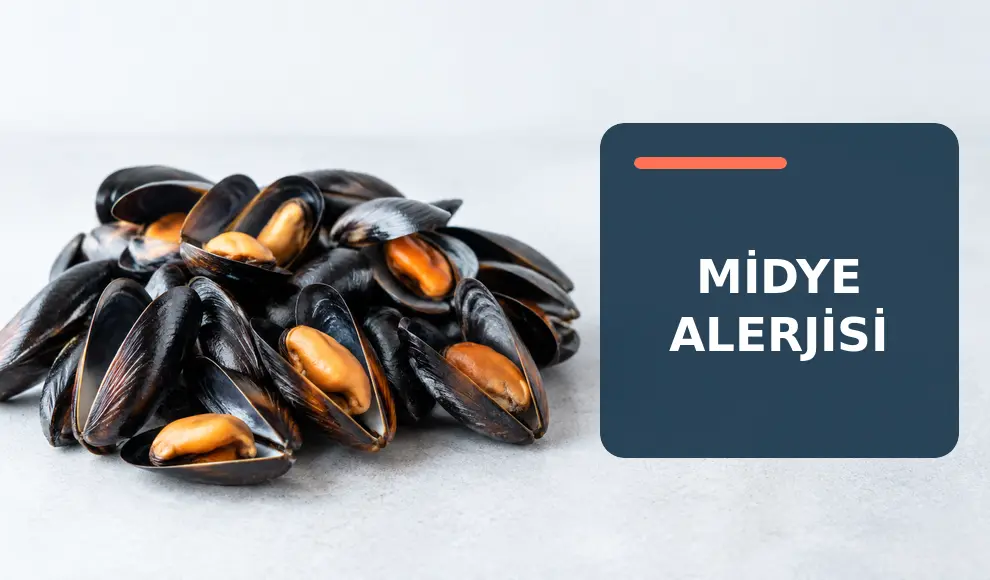 Midye Alerjisi