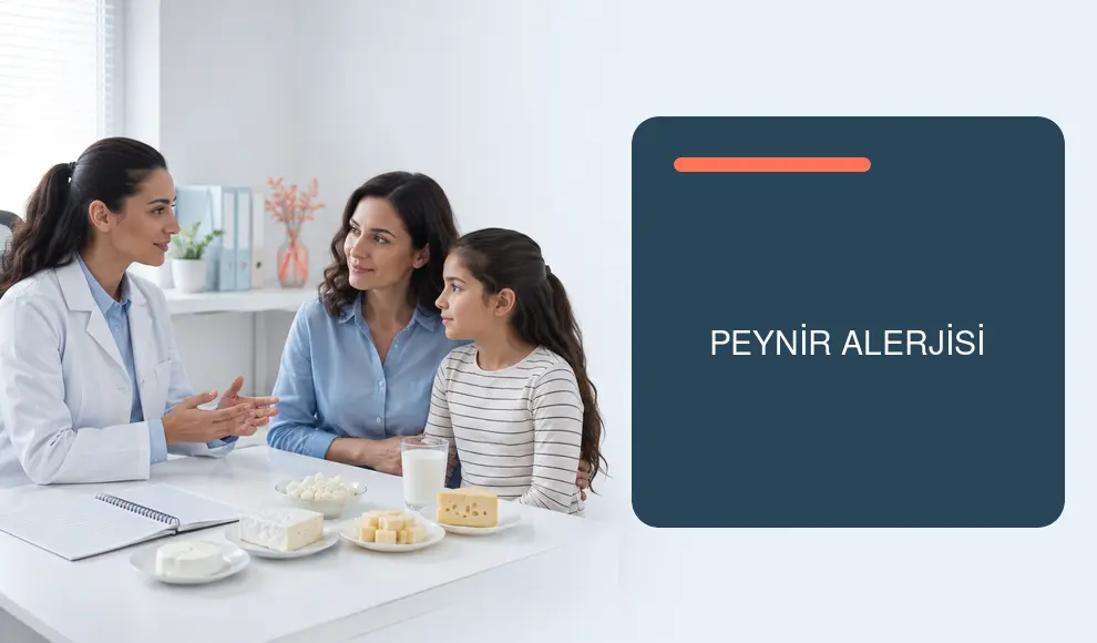 Peynir Alerjisi