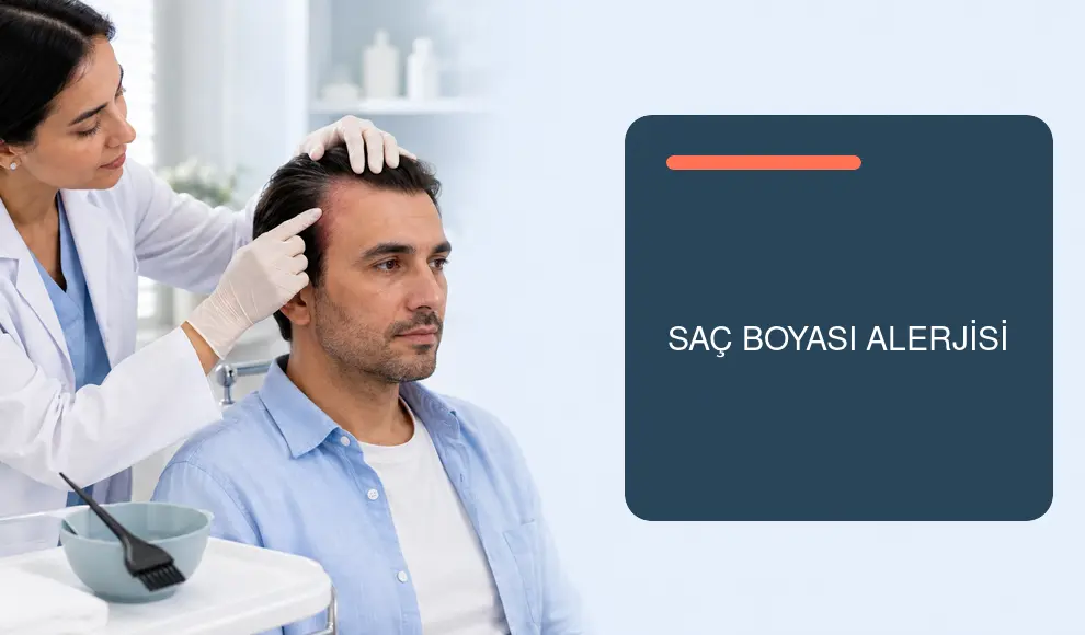 Saç Boyası Alerjisi Saç Boyası Alerjisi