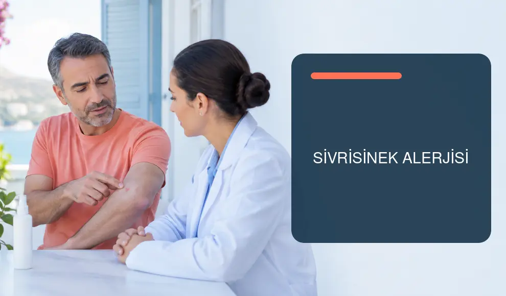 Sivrisinek Alerjisi Sivrisinek Alerjisi