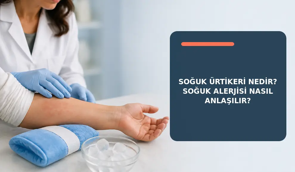Soğuk Ürtikeri Nedir? Soğuk Alerjisi Nasıl Anlaşılır?