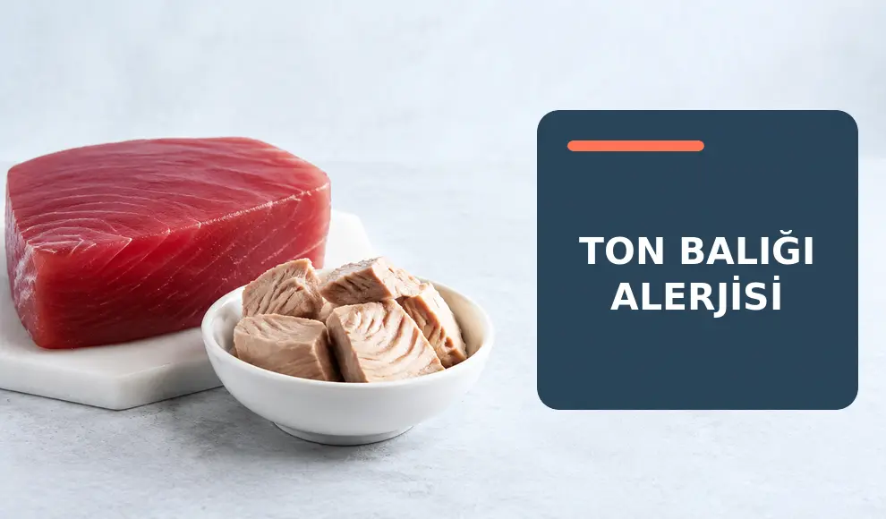 Ton Balığı Alerjisi